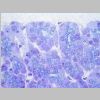 Pancreas SF 10.jpg